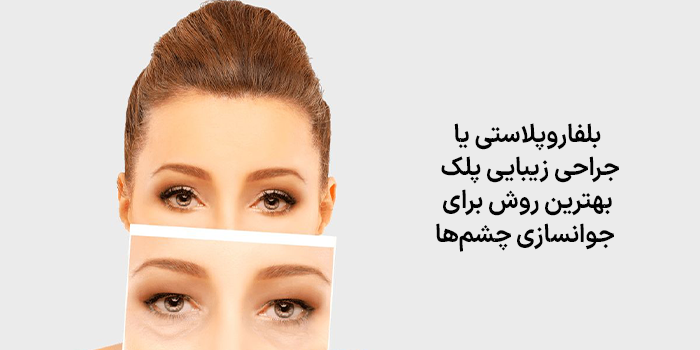 بلفاروپلاستی (جراحی زیبایی پلک) بهترین روش برای جوانسازی چشمها