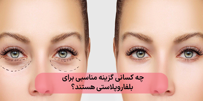 چه کسانی گزینه مناسبی برای بلفاروپلاستی هستند؟