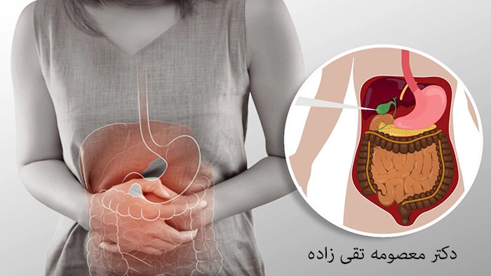 بهترین جراح کیسه صفرا در کرمان